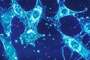 cancer cells